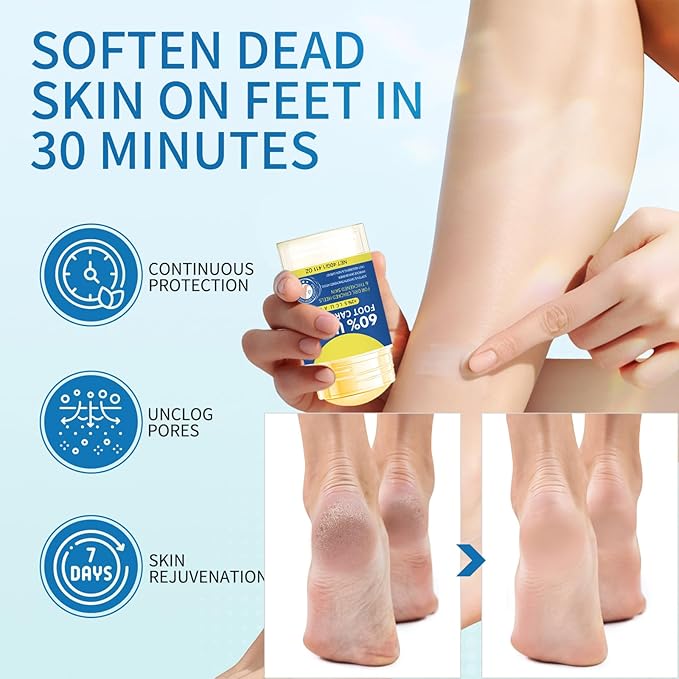 60% Urea Cracked Foot Heel Sticks - 2PCS Foot Balm Cream for Dry Cracked Feet with ALoe Vera Moisturizing Stick - Soften Feet Calluses Rough Skin Elbows Knees Hands - Foot Moisturizer Lotion for Women