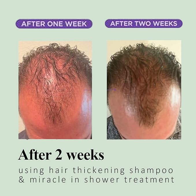 Rosemary & Biotin Shampoo for Hair Growth & Thinning Hair - Sulfate-Free, Vegan Formula with Hydrolyzed Keratin to Thicken, Strengthen & Revitalize Dry, Damaged Hair - For Men & Women