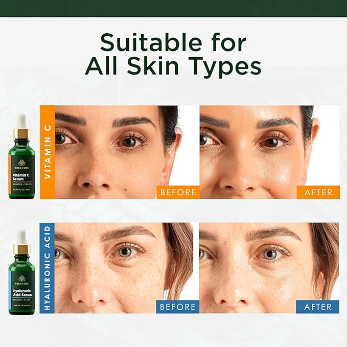 Tree of Life Beauty Facial Skin Care Set, Brightening, Firming, Hydrating, Dry Face, Dermatologist Tested - Vitamin C and Hyaluronic Acid Facial Serum - Skin Care Kit, 2 count of 1 Fl Oz
