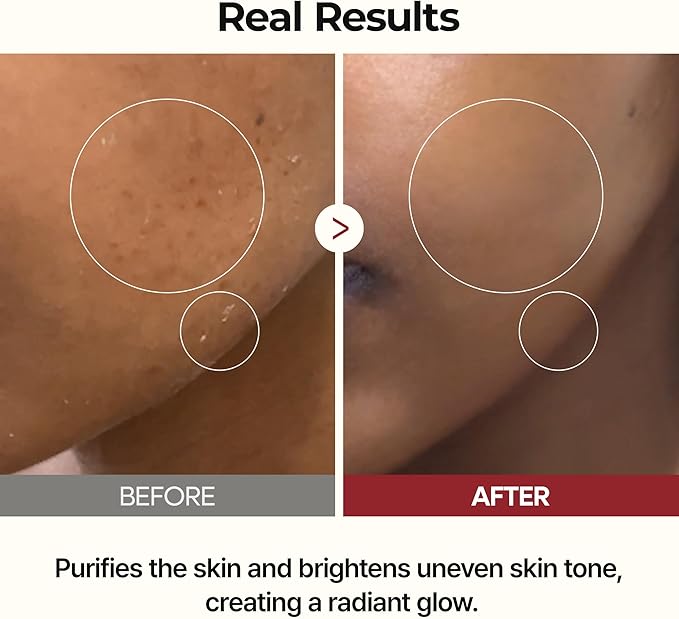 Dr.Melaxin Peel Shot Glow Rice Toner with Rice Extract & Ceramides, Hydrating & Skin Refining Face Toner for Glass Skin, Liposome Oil for Deep Moisture & Barrier Care, Korean Skincare, 6.76 fl.oz