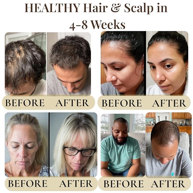 Revatology Hair Growth Oil for Adults, Ayurvedic Pre Wash and Overnight Scalp Treatment for Thinning Hair, 30 Cold Pressed Botanicals with Rosemary and Castor Oil, Made in USA