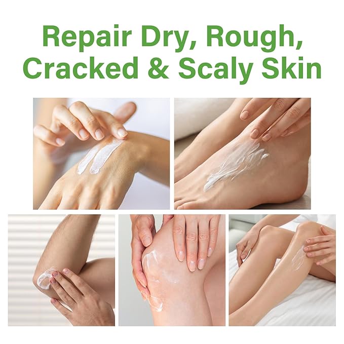 Urea Cream 60 Percent for Feet Maximum Strength, Foot Cream for Dry Cracked Heels and Feet, Foot Moisturizer, 5.29oz/150g