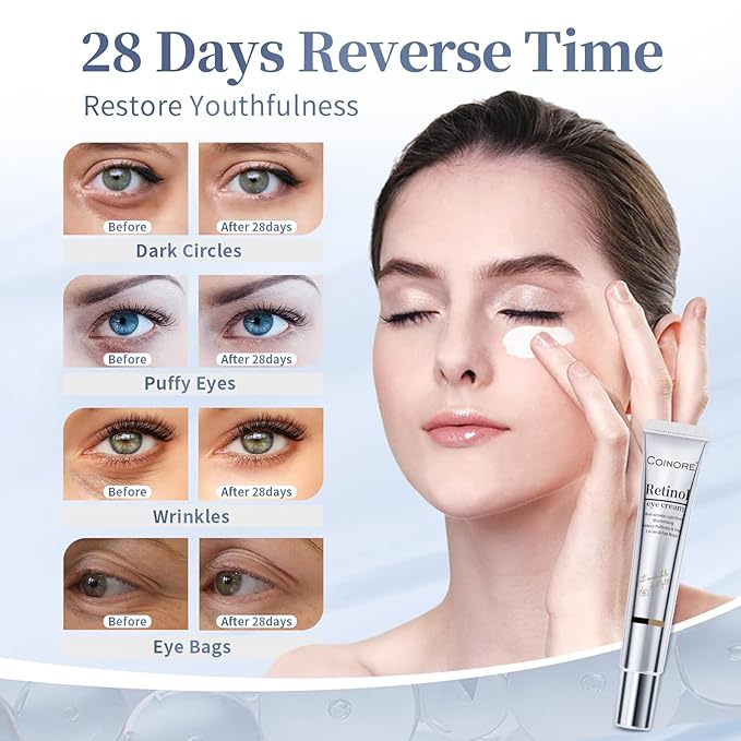 Retinol Under Eye Cream - Anti Aging Eye Cream for Dark Circles, Puffiness, Wrinkles, Reduces Eye Bags, Fine Lines & Crow’s Feet for Women & Men, 0.7 Fl Oz