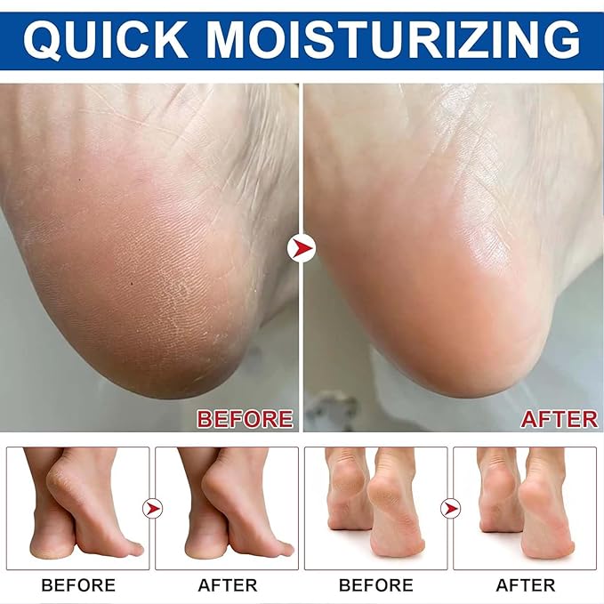 2Pcs Urea Foot Cream,Hydrating and Nourishing Foot Balm Stick,Foot Repair for Dry Skin and Rough Heels,Hands,Knees Skin Care Heel Treatment (Aloe Vera & Avocado, Scent B)