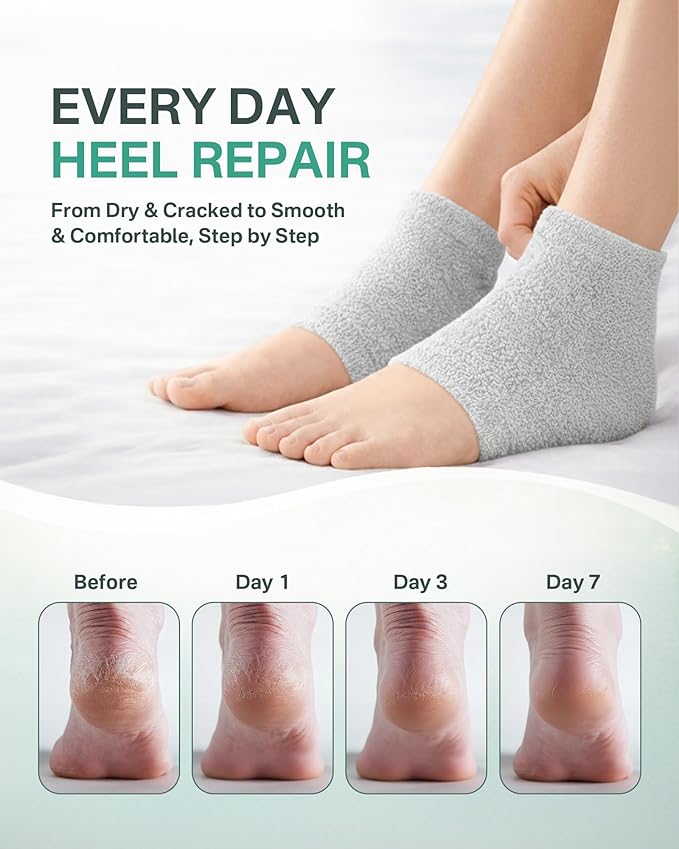 Moisturizing Socks Women, Feather Yarn Gel Socks, Foot Moisturizing Socks(Size 9-11) Deeply Hydrating for Dry, Cracked Heels, Silicone Socks for Women, Perfect Galentines Day Gifts, 1 Pair (Heel-Gray)