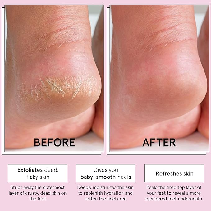 grace & stella Award-Winning Foot Peel Mask - Foot Peeling Mask with Aloe Vera - Moisturizing Foot Mask for Dry Cracked Feet - Foot Exfoliator for Baby Soft Feet (4 Pairs, Unscented)