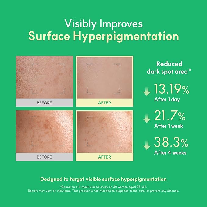 Easydew DW-EGF Melatoning Ampoule 3X - Hydrating Dark Spot Serum with Niacinamide & Glutathione for Uneven Skin - Fast Absorbing Day & Night Ampoule Korean Skin Care (Pump 0.27 fl oz, EGF 3X)