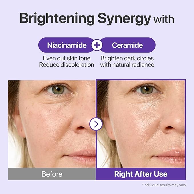 numbuzin No.9 NAD+ Retinal Volumetox Eye Cream, Anti-Aging Treatment for Wrinkles, Fine Lines, Dark Circles & Dark Spots, Gentle Retinal Formula with Peptides & Niacinamide, 0.67 fl. oz.