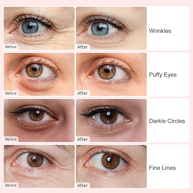Under Eye Patches(40 Pairs), Collagen Crystal Eye Mask with Hyaluronic Acid, Under Eye Mask for Dark Circles, Puffy Eyes, Wrinkles, Treatment Skin Care