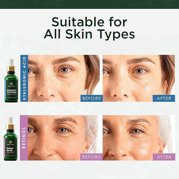 Facial Skin Care Set, Brightening, Firming, Hydrating, Dry Face, Dermatologist Tested - Retinol Serum and Hydrating Hyaluronic Acid - Skin Care Kit, 2 count of 1 Fl Oz