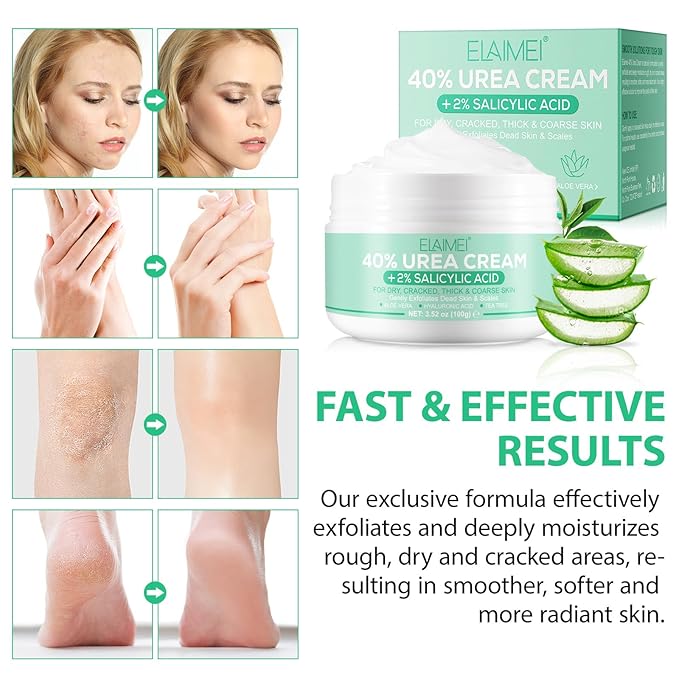 Urea Cream 40 percent for feet maximum strength-Urea Foot Cream 40% for Dry Cracked Heels, Knees, Elbows - With 2% Salicylic Acid, Hydrating Repair Treatment,Deep Moisturizes,3.52 oz