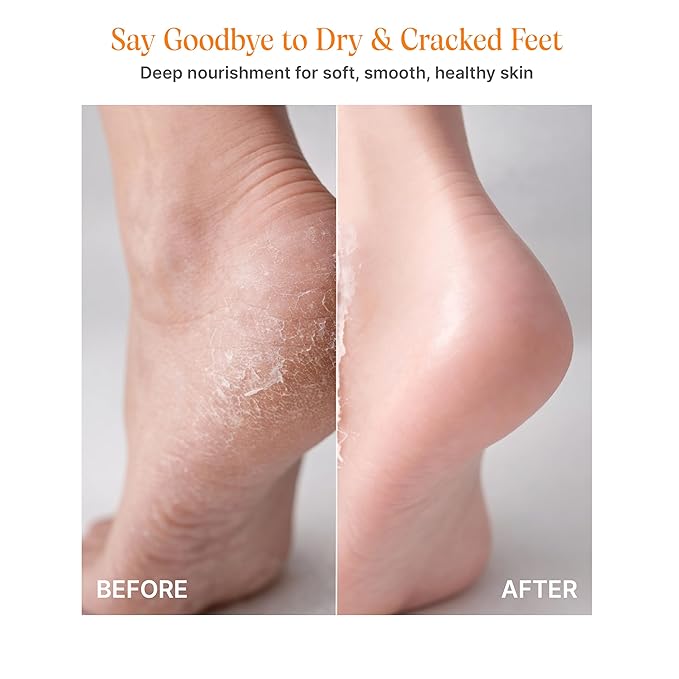 Lhamour Foot Cream Cracked Heel - Heel Balm & Foot Moisturizer for Dry Cracked Feet, Natural Beef Tallow & Beeswax Foot Balm with Peppermint & Thyme, Organic Callus Repair Salve for Rough Skin,1.06 oz