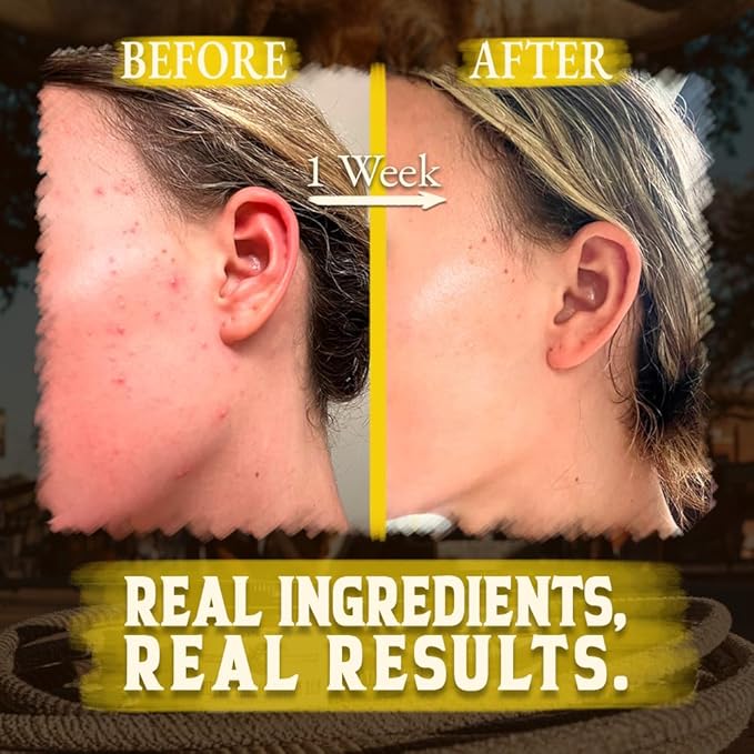 Organic Beef Tallow for Skin - 4 OZ (Citrus) — US-Made Grass Fed Beef Tallow for Face + Body — Whipped Tallow and Honey Balm Moisturizer for Dry and Sensitive Skin, Eczema, Rosacea (No Additives)