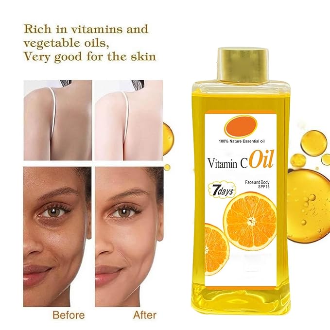 Vitamin C Oil for Massage and Skin Moisturizing, Lightweight Hydrating Body Oil for Dry Skin, Spa Body Care Oil, 200ml / 6.76 fl oz