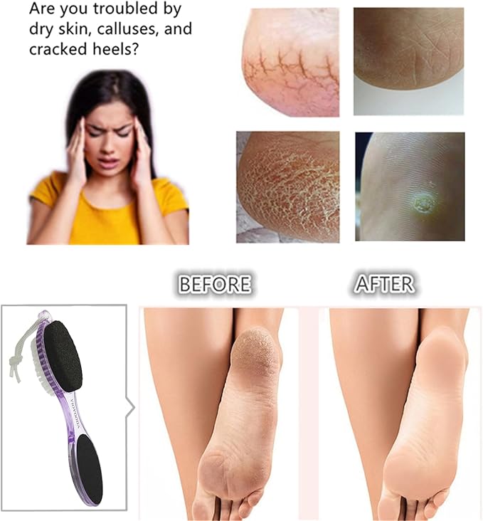 Foot File Callus Remover 4-in-1, Feet Scraper Pedicure Tools with Pumice Stone, Scrubber Brush, Foot Rasp and Sand Paper, Double Sided Multi Purpose, Clear Blue and Purple