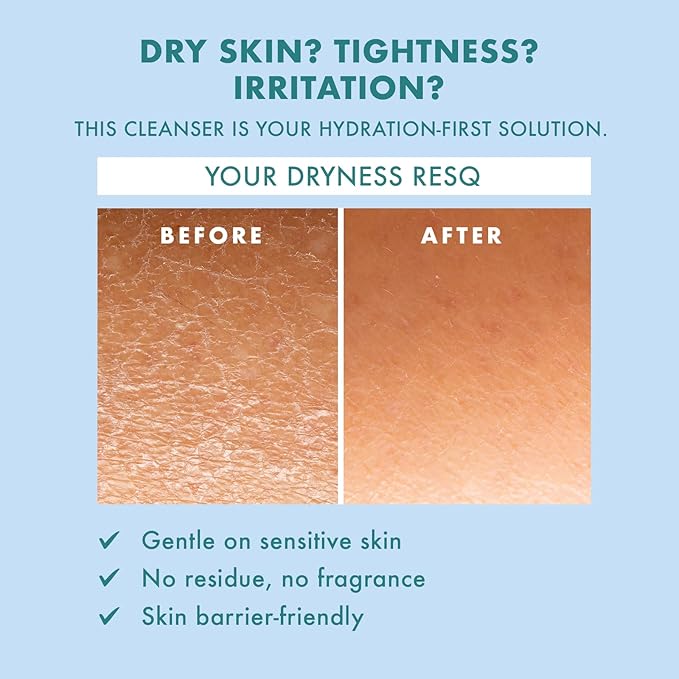 Skin ResQ by Petal Fresh Hello Hydration Cleanser, Daily Gentle Foaming Facial Cleanser with 2% Squalane Complex and Aloe Vera, Fragrance Free Hydrating Face Wash for Dry Sensitive Skin, 10 oz