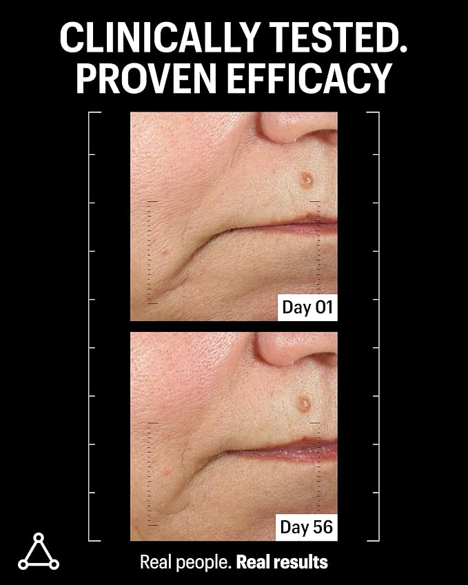 Allies of Skin Peptides & Antioxidants Advanced Firming Daily Treatment with 13 Brighteners, 9 Antioxidants, 7 Firming Peptides, 5% Teprenone & Ferulic Complex and 3% Biotech Algae Complex 75ml/2.5oz