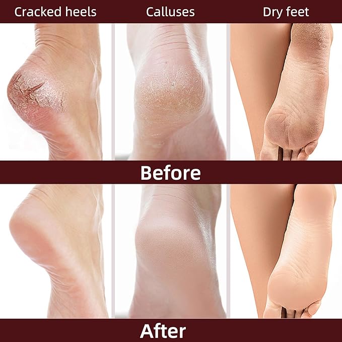 Hydrating Foot Masks Set for Women Men,6 Pack Socks Mask for Dry Cracked Feet（Milk）
