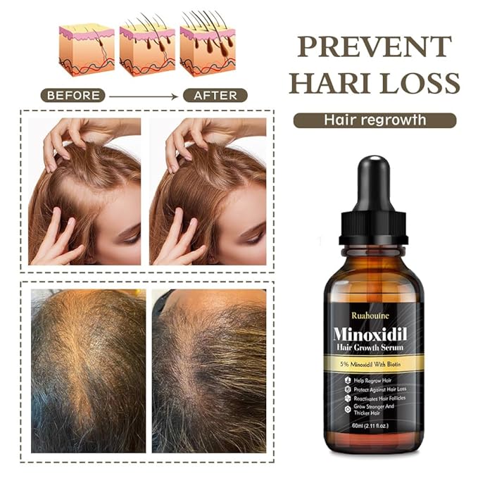 Ruahouine Hair Growth Treatment for Thicker Longer, 5% Minoxidil Biotin Hair Growth Serum Oil for Men and Women, Prevents Hair Loss and Thinning, 2.11 fl.oz