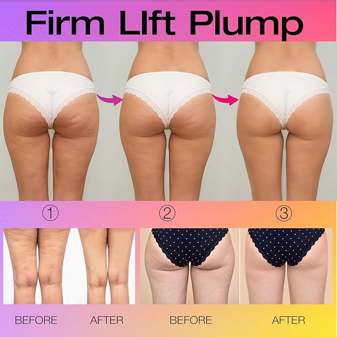 Butt TIGHT Lift Firm Cream - Tighten and Firm Booty, Reduce Loose and Crepey Skin, Cellulite Cream for Visible Firmness, Reduce Cellulite Appearance 100 ml