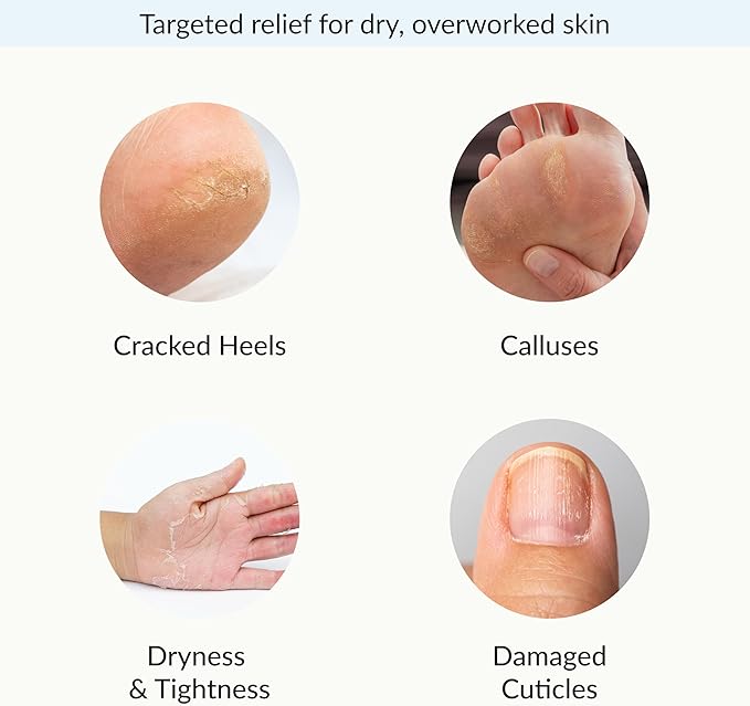 Epielle Intensive Repairing Hand & Foot Masks, Restore and Moisturize Dry, Cracked Skin, Self Care Gifts for Women, Spa Kit, Mothers Day Gifts, 6 Moisturizing Gloves & 6 Moisturizing Socks