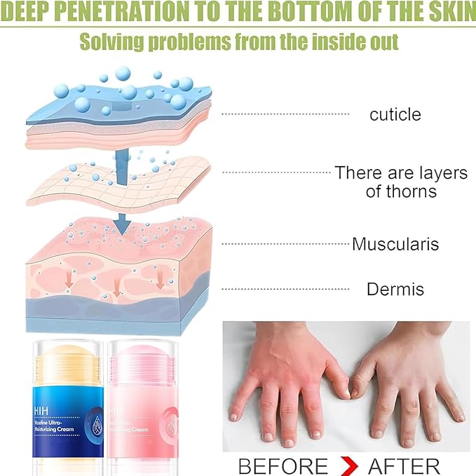 Cracked Repair Cream, 2Pcs Cream For Dry Cracked Skin, Peach Cracked Heel Stick, Rolling Use Moisturizing Balm For Dry Cracked Feet Hands And Elbows (40gx 2)