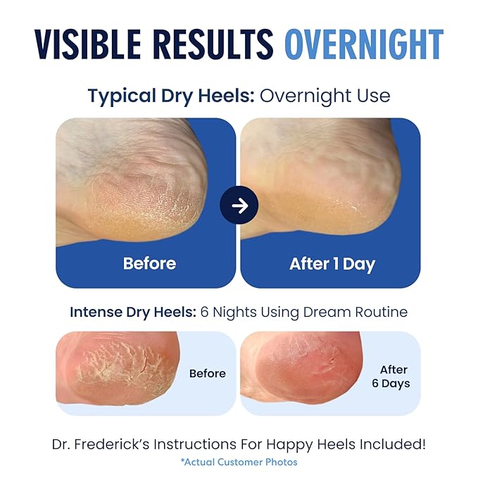 Dr. Frederick's Original Moisturizing Heel Socks for Dry Cracked Heels Treatment - Infused with Olive Oil, Jojoba Oil and Vitamin E - 2 Pairs - Self Care Gifts for Women & Men - Blue Jojoba