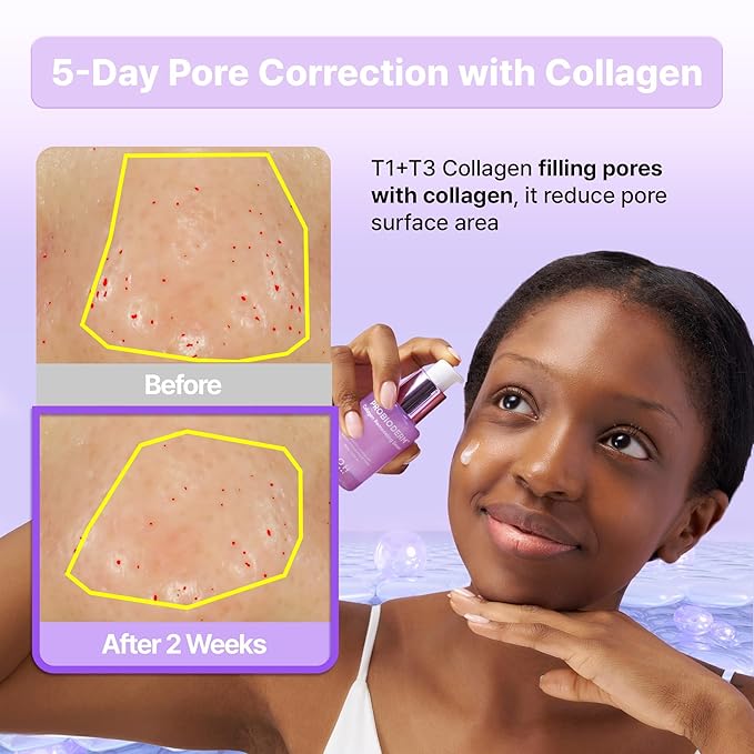 BIOHEAL BOH Probioderm™ Collagen Remodeling Serum 1.01 fl oz (30 ml) | Skin Firming Serum with Collagen & 12 Peptides for Pore Tightening & Smoothing | Hydrating & Lifting for Daily Skincare