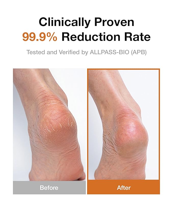 Curoheal Foot Repair Cream – Intensive Moisturizer for Dry, Cracked Heels & Calluses – Concentrated Balm Formula with Shea Butter, Petrolatum, and Patented Magnolia Extract