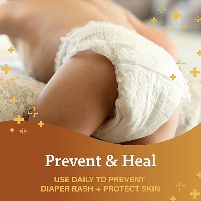A+D Original Diaper Rash Ointment Prevents & Treats Diaper Rash, Moisturizing Skin Protectant with Vitamins A & D, Healing Skin Ointment for Dry and Cracked Skin 16 oz
