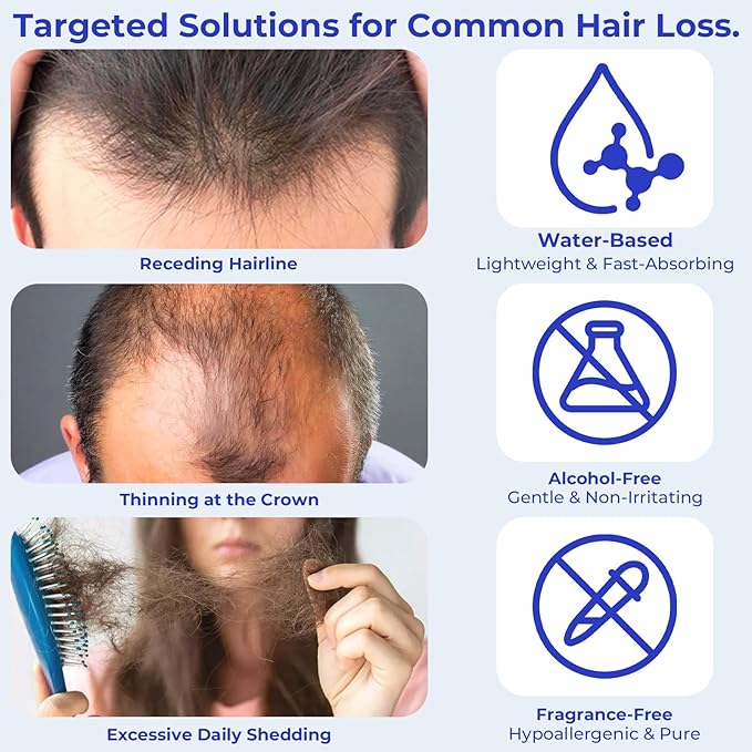 Rosemary Oil Hair Growth Serum Roll On – 3% Rosemary Oil, 2% Caffeine, 2% Niacinamide & DHT Blocking Complex, Non-Greasy Scalp Serum for Men & Women, Designed for Thinning, Fine & Weak Hair