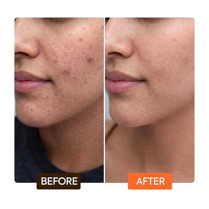 Makari Naturalle Carotonic Extreme Brightening Serum SPF15 (1.7 oz) 2-Pack | Helps Improve the Look of Blemishes & Uneven Areas | Brightening & Smoothing Serum with Antioxidant Support