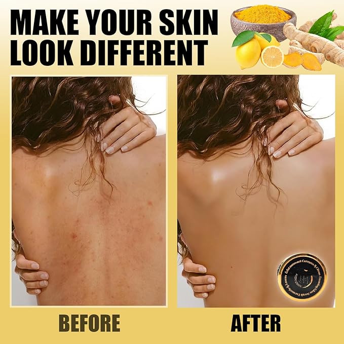 Foaming Body Scrub, Exfoliating Turmeric Scrub and Skin Exfoliator for Dark Spots, Turmeric Body Scrub for All Skin Types, Gently Exfoliates Face, Body Hands & Foot, Moisturized Skincare, 9.87oz/280g