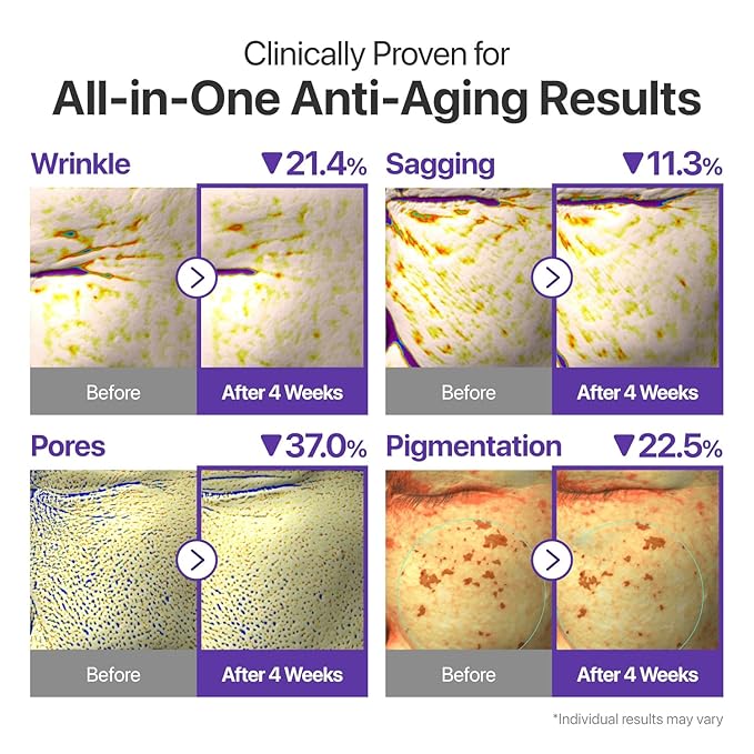 numbuzin No.9 NAD+ Retinal Volumetox Eye Cream, Anti-Aging Treatment for Wrinkles, Fine Lines, Dark Circles & Dark Spots, Gentle Retinal Formula with Peptides & Niacinamide, 0.67 fl. oz.