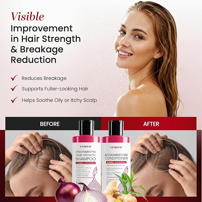 Gentle Shampoo & Conditioner Set for Thinning Hair and Itchy Scalp – Natural Biotin, Onion & Rosemary Formula, Sulfate Free, Paraben Free, Nourishing, Safe for Sensitive Scalp, 25 Fl Oz