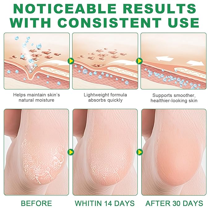 60% Urea Aloe Foot Cream Maximum Strength for Cracked Heels and Dry Skin, Deep Moisturizing Urea Cream, Foot Stick Cracked Heel Repair Cream, Repairing Creams for Heels, Knees, Elbows & Hands 1.41 oz