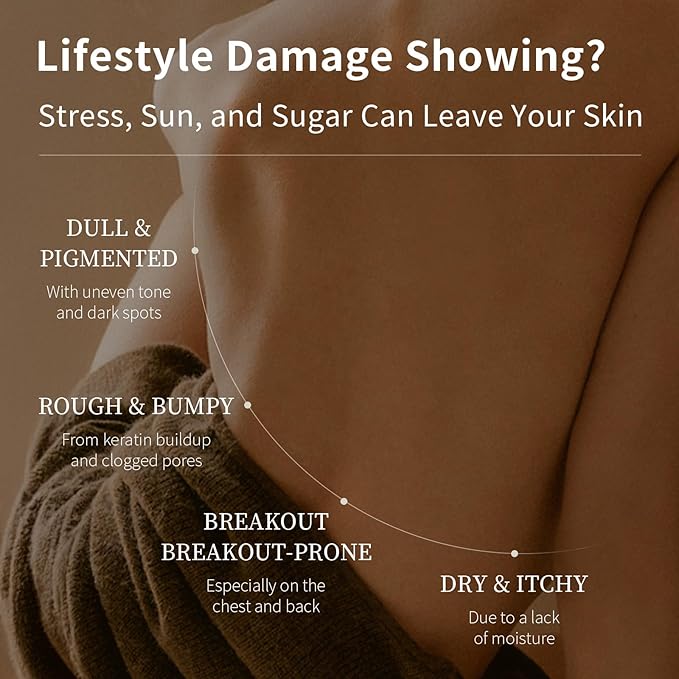 Advanced AHA Body Lotion 12% Glycolic Acid Treats Back Acne, Keratosis Pilaris & Dryness - With Glycolic, Lactic, Citric Acids - Exfoliating Moisturizer with Long Lasting Perfumed Experience,14 Oz