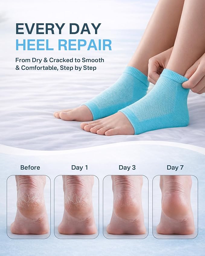 Moisturizing Socks, 100% Cotton Heel Socks for Dry Cracked Feet Women, Cracked Heel Treatment Silicone Heel Socks, Breathable Hydrating Gel Heel Protectors for Repair, Spa & Daily Use, 2 Pairs, Blue