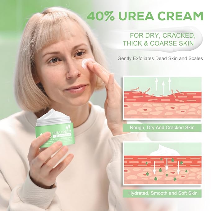 Urea Cream 40%, with 2% Salicylic Acid 4.23 oz, Powerful Softening of Cracked Heels, Quick Absorption, Urea Foot Cream for Dry Heels, Hands, Feet, Knees & Elbows