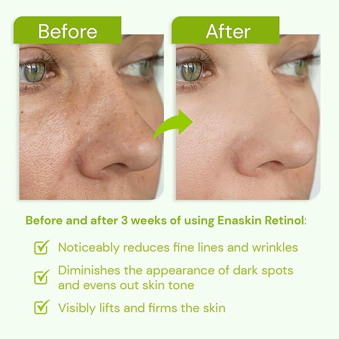 Retinol Serum for Face – Anti-Aging for Fine Lines & Wrinkles, Firms & Hydrates, Hyaluronic Acid & Peptides, Night Moisturizer Serum for Women/Men, Fragrance-Free, 1.0 fl.oz