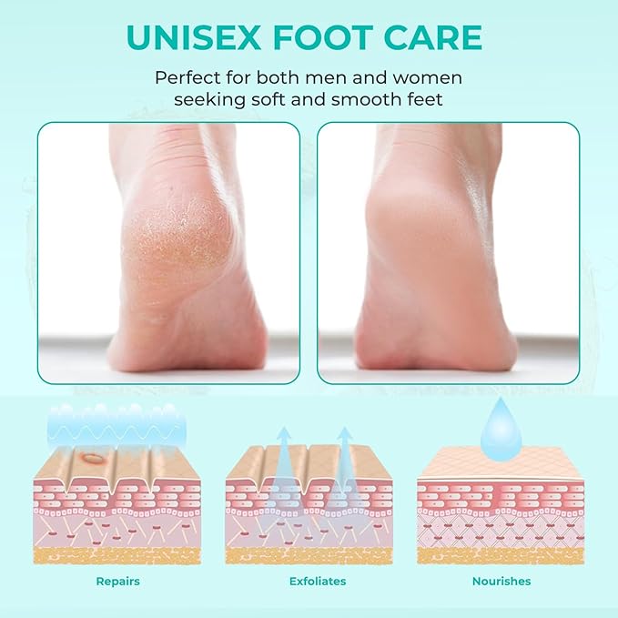 Happy Feet Coconut Exfoliating Foot Peel Mask – 3 Pack | Foot Peeling Mask for Dead Skin Removal, Smoother & Softer-Looking Feet, At-Home Foot Care Spa Treatment
