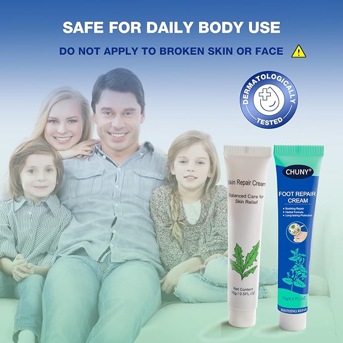 CHUNY Foot Cream for Cracked Heels Cream - Extra Strength for Cracked Heels, Dry Skin & Itchy Feet – Soothes Burning, Scaling & Irritation for Men and Women