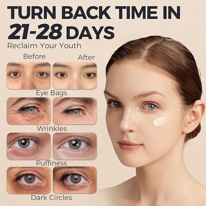 Retinol Under Eye Cream – Anti Aging Eye Cream for Puffiness and Bags Under Eyes & Wrinkles, Firming and Moisturizing, Gentle Formula for Men & Women to Reduce Fine Lines 0.7 Fl.Oz