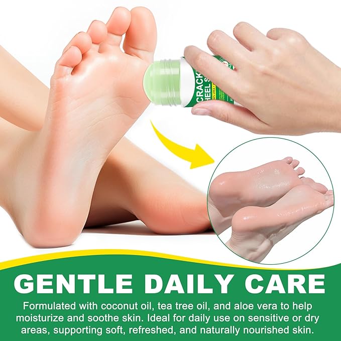 2 Pcs 60% Urea Cream Stick Plus 2% Salicylic Acid, Urea Foot Cream with Aloe Vera for Rough, Dry Feet, Calluses and Cracked Heels, Foot Moisturizing Balm