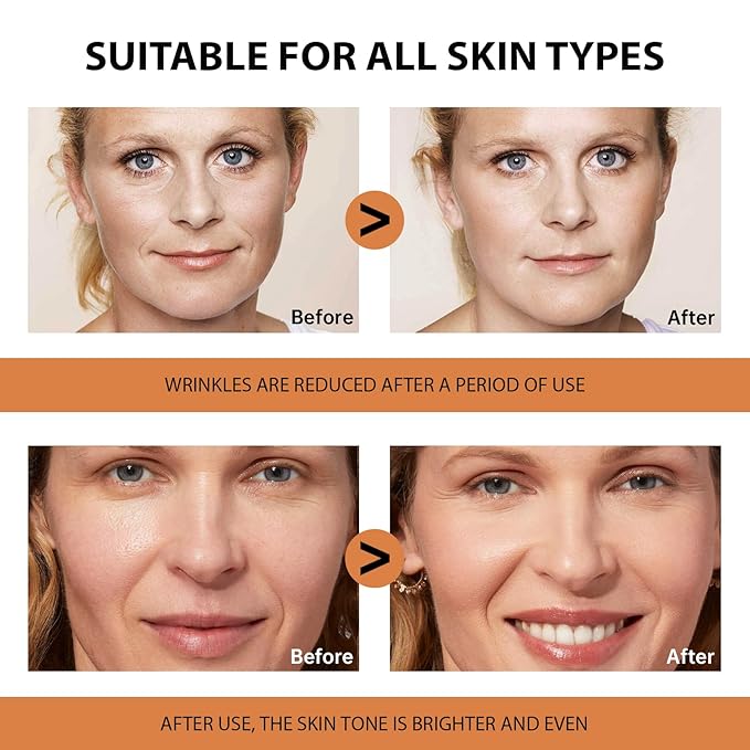 VGO Vitamin C Serum for Face, Vit C Anti Aging Serum with Hyaluronic Acid & Vitamina E, Deep Hydration Facial Care for All Skin Types, 1.01oz / 30ml