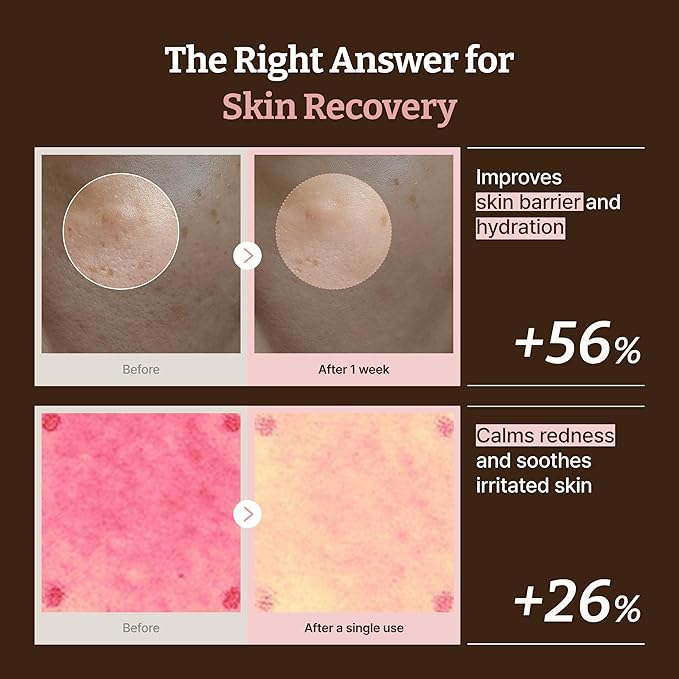 Dr.Reju-All Advanced PDRN Rejuvenating Cream Max – 99% Pure Salmon DNA Gel Type Face Moisturizer – Optimal 1200ppm for Glass Skin & Plumping – Korean Pharmacy Anti-Aging Skin Care Face Cream -2 Fl Oz