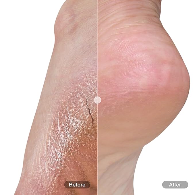 Du'it Foot & Heel Balm Plus 50ml