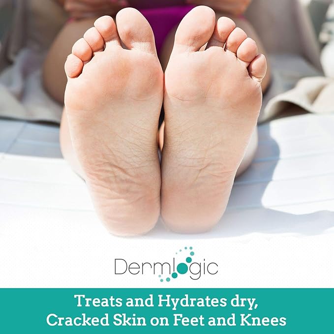 Dermlogic Keratosis Pilaris Treatment- Get Rid of KP, Bumps & Body Acne. 12% Lactic Acid Lotion. Moisturizing Repair Cream Smooths Rough, Dry, Cracked, Bumpy Skin & Redness.