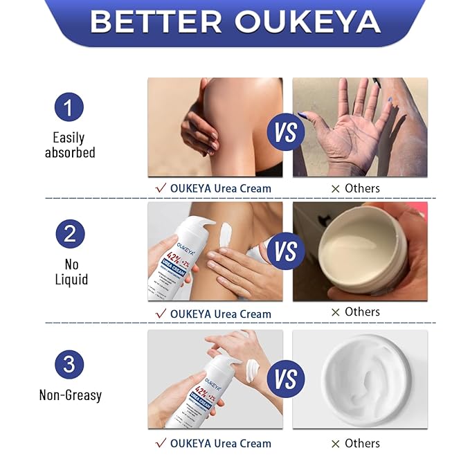 OUKEYA Urea Cream 42% with 2% Salicylic Acid, Urea Foot Cream for Dry, Rough Skin – Moisturiser for Feet, Heels, Hands & Elbows, 5.29 Oz
