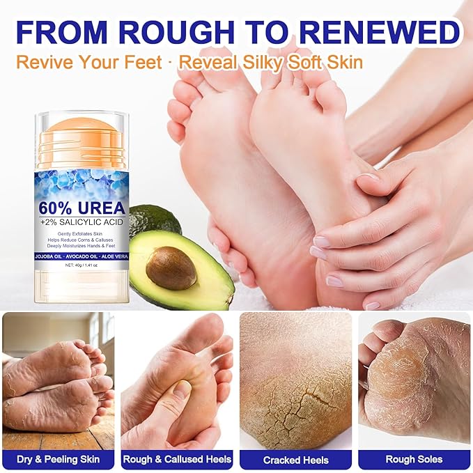 60% Urea with 2% Salicylic Acid Urea Foot Care Stick, Foot Cream Moisturizer for Dry Cracked Feet, Knees, Elbows, Hands,Moisturizes and Hydrates the Dry Skin,Callus Remover & Skin Softener -1.41oz